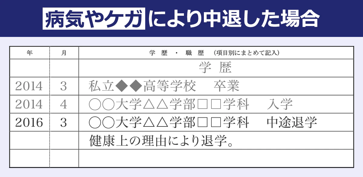 【病気やケガにより中退した場合の学歴・職歴の書き方】 「○○大学△△学部□□学科　中途退学」の次の行に「健康上の理由により退学。」のように記述